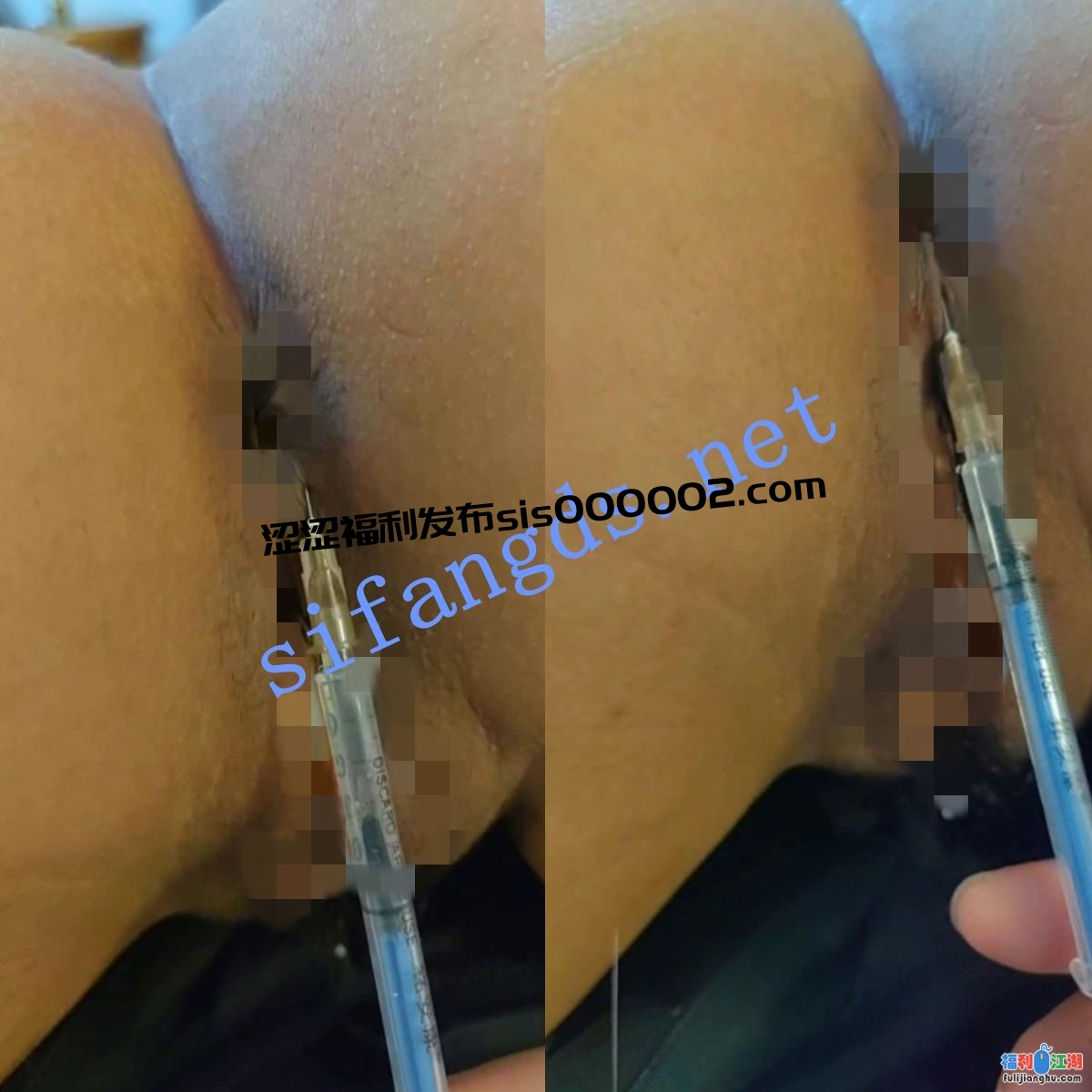 ❤️【打针】真实打针 屁股 屁眼 阴部看着都疼！【0.42G】